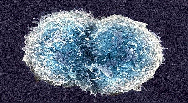 stem cell technology upsc essay notes mindmap