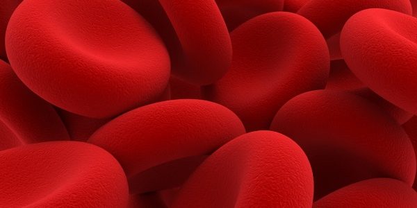 Anemia
