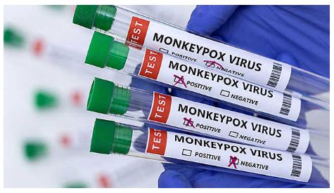 [Editorial] The Monkeypox virus: origins and outbreaks